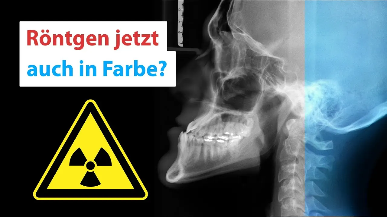 Standbild aus dem Erklärvideo „Warum sind Röntgenbilder immer noch schwarz-weiß?“